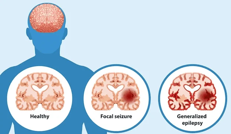 Cognitive Psychology